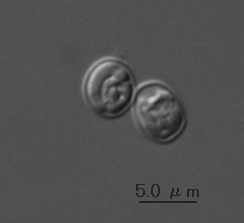 クリプトスポリジウム顕微鏡写真
